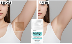 Dark Spot Remover for Body, Skin Bleaching Cream with Vitamin C for Intimate Areas, Skin Lightening